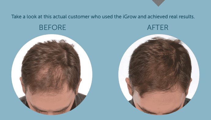Igrow casco per capelli
